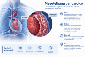 Infografica sul mesotelioma pericardico
